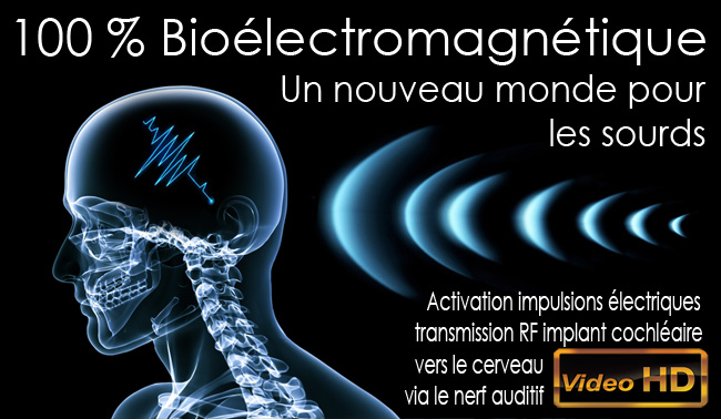 Homme_Bioelectromagnetique_Implant_cochleaire_ impulsion_oreille_interne_nerf_auditif_Flyer_News